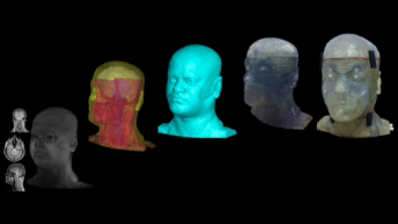   3D Printed Phantom Head  