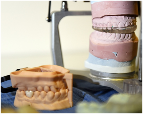  3D Printed Dental Guard Created with a Formlabs Form 2 Printer [Source:  U.S. Air Force  / U.S. Air Force photo by Louis Briscese] 