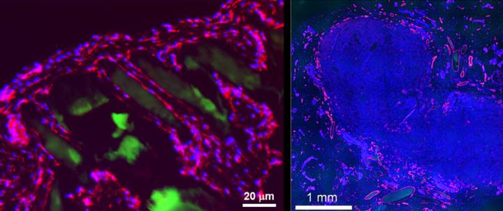  Prellis structure transplanted alone is surrounded by single cell walled capillaries within two weeks of transplantation into immunocompetent mouse (left). Human tumor cells transplanted in Prellis structures grow rapidly, are highly vascularized and demonstrate minimal hypoxia (right) (red = CD31, blue = DAPI, green = printed structure) [Image: Prellis Biologics] 