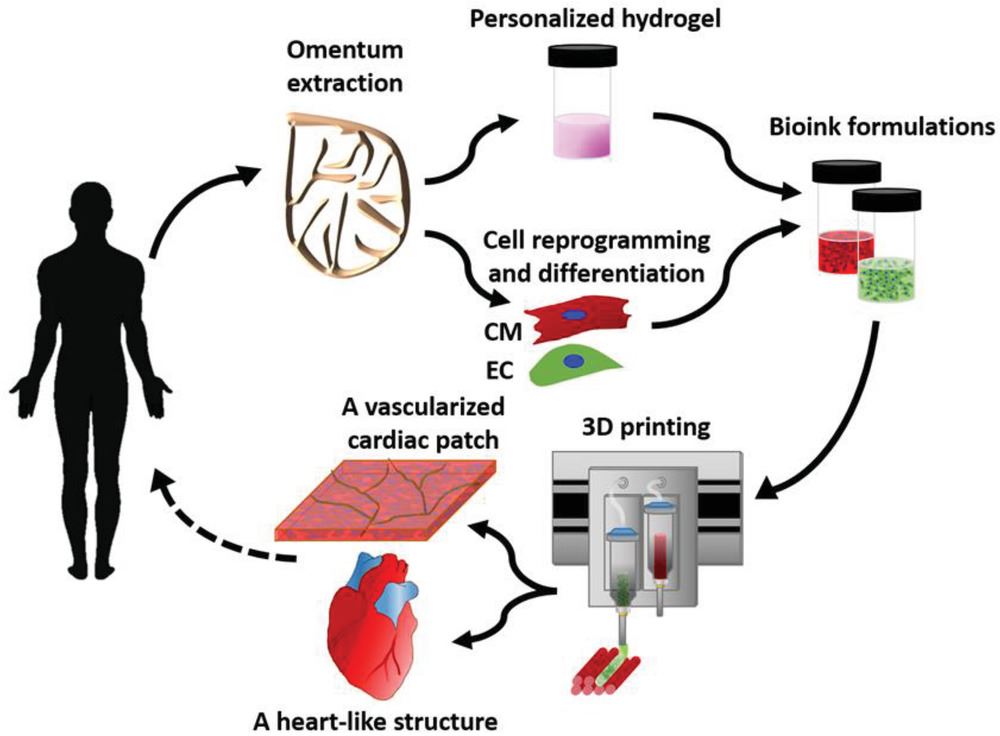  Concept schematic. An omentum tissue is extracted from the patient and while the cells are separated from the matrix, the latter is processed into a personalized thermoresponsive hydrogel. The cells are reprogrammed to become pluripotent and are then differentiated to cardiomyocytes and endothelial cells, followed by encapsulation within the hydrogel to generate the bioinks used for printing. The bioinks are then printed to engineer vascularized patches and complex cellularized structures. The resulting autologous engineered tissue can be transplanted back into the patient, to repair or replace injured/diseased organs with low risk of rejection. [Image: Tel Aviv University] 
