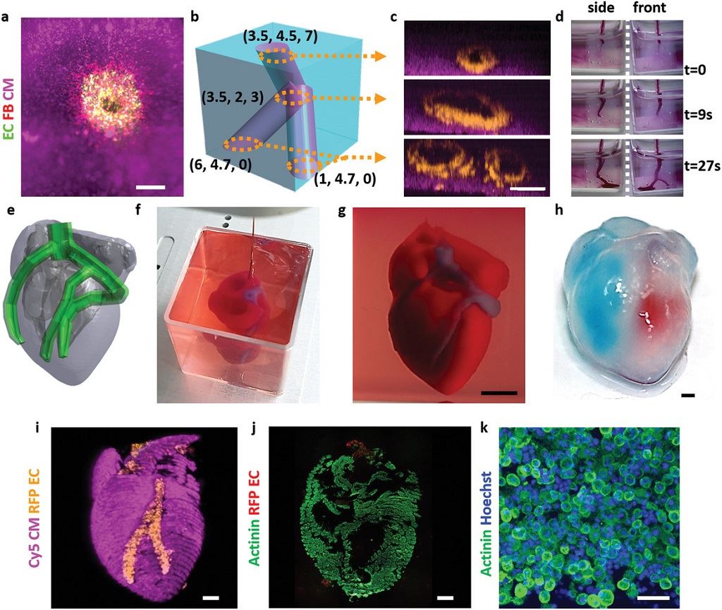  Printing thick vascularized tissues. a) A top view of a lumen entrance (CD31; green) in a thick cardiac tissue (actinin; pink). b) A model of a tripod blood vessel within a thick engineered cardiac tissue (coordinates in mm), and c) the corresponding lumens in each indicated section of the printed structure. d) Tissue perfusion visualized from dual viewpoints. e–k) A printed small‐scaled, cellularized, human heart. e) The human heart CAD model. f,g) A printed heart within a support bath. h) After extraction, the left and right ventricles were injected with red and blue dyes, respectively, in order to demonstrate hollow chambers and the septum in‐between them. i) 3D confocal image of the printed heart (CMs in pink, ECs in orange). j,k) Cross‐sections of the heart immunostained against sarcomeric actinin (green). Scale bars: (a,c,h, i,j) = 1 mm, (g) = 0.5 cm, (k) = 50 µm. [Image: Tel Aviv University] 