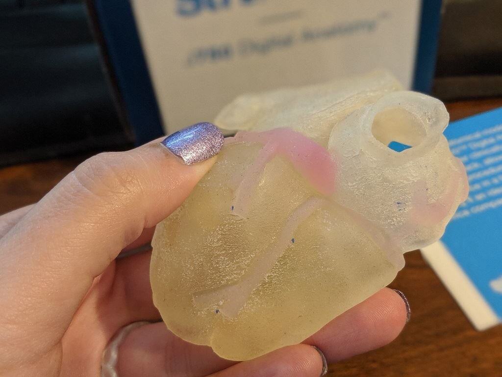  Hands-on with the 3D printed heart [Images: Fabbaloo] 