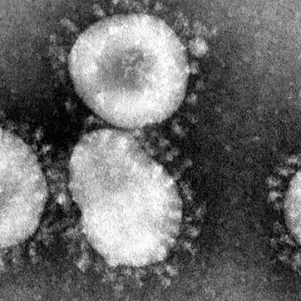  Microscopic image of the Coronavirus [Source: CDC via MyMiniFactory] 