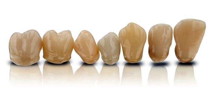  3D printed dental crowns [Source: Formlabs] 