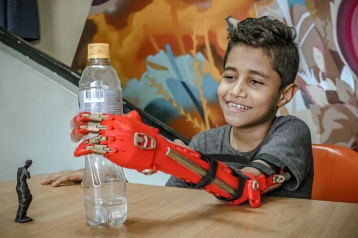  3D printed prosthetics in Colombia [Source:  e-NABLE Medellín ] 