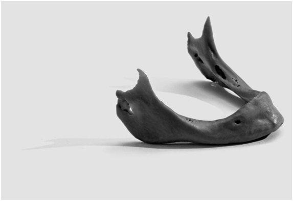  3D printed jawbone [Source: FormLabs] 