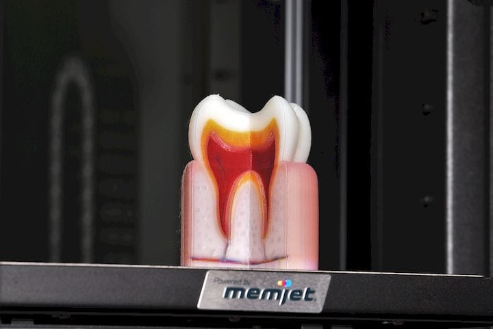  Full color 3D printed tooth model [Source: OWE] 