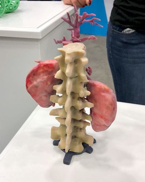  A full color kidney 3D print made on a Stratasys J750 [Source: Fabbaloo] 