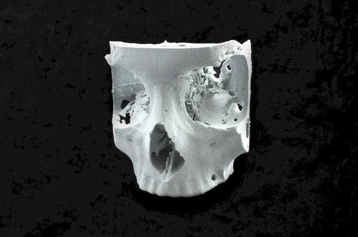 A human skull 3D printed in flexible white material [Source: Sinterit] 