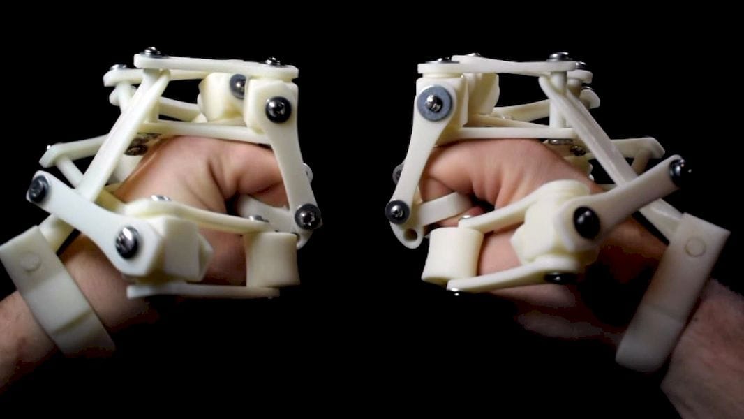  3D printed exoskeletons on each hand! 