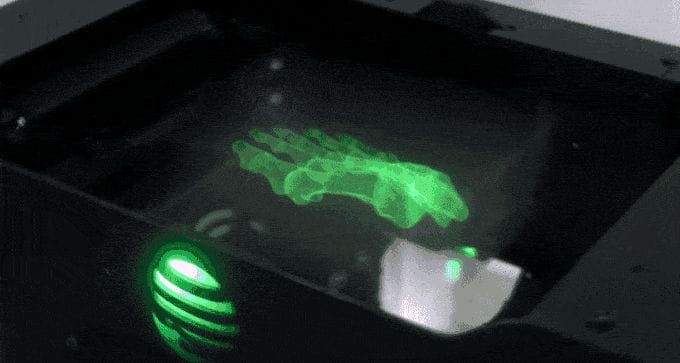  X-ray view of a human foot visualized with Lumi Industries' new VVD 