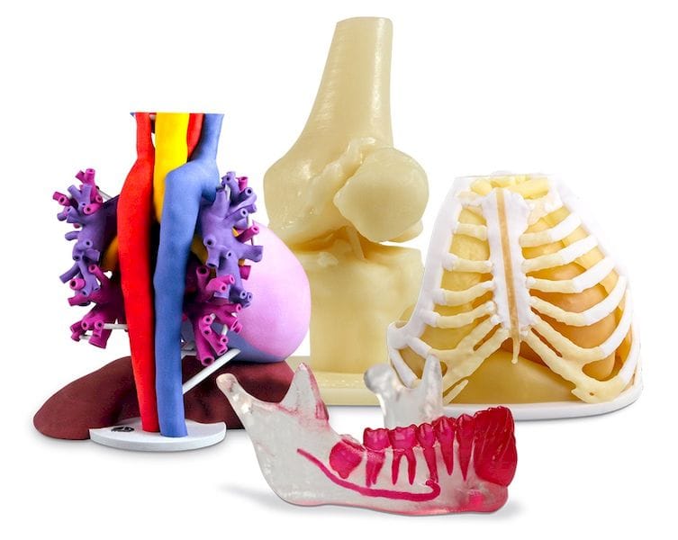  Colorful, but highly useful 3D prints of anatomical structures from 3D Systems 
