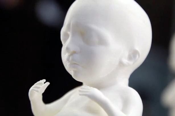  Closeup detail of a 3D printed human embryo 