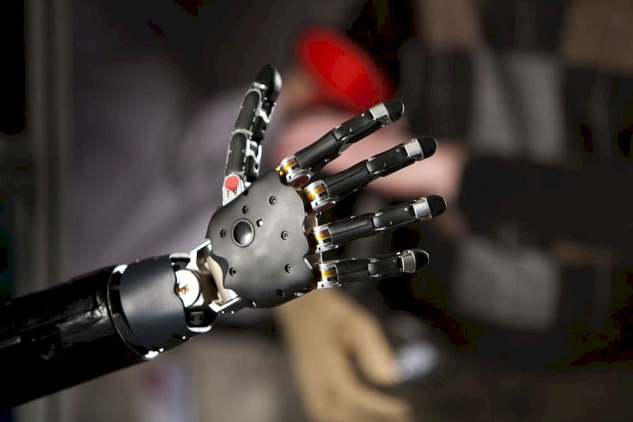  A brain-controlled 3D printed prosthetic arm ( Courtesy Wikimedia ) 