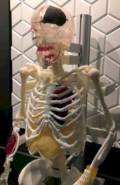  “Lucky,” victim of bone cancer, skull and wrist fractures, needy of jaw realignment, greets visitors at 3D Systems’ Denver area facility, an example of the company’s expertise in creating customized body parts. 