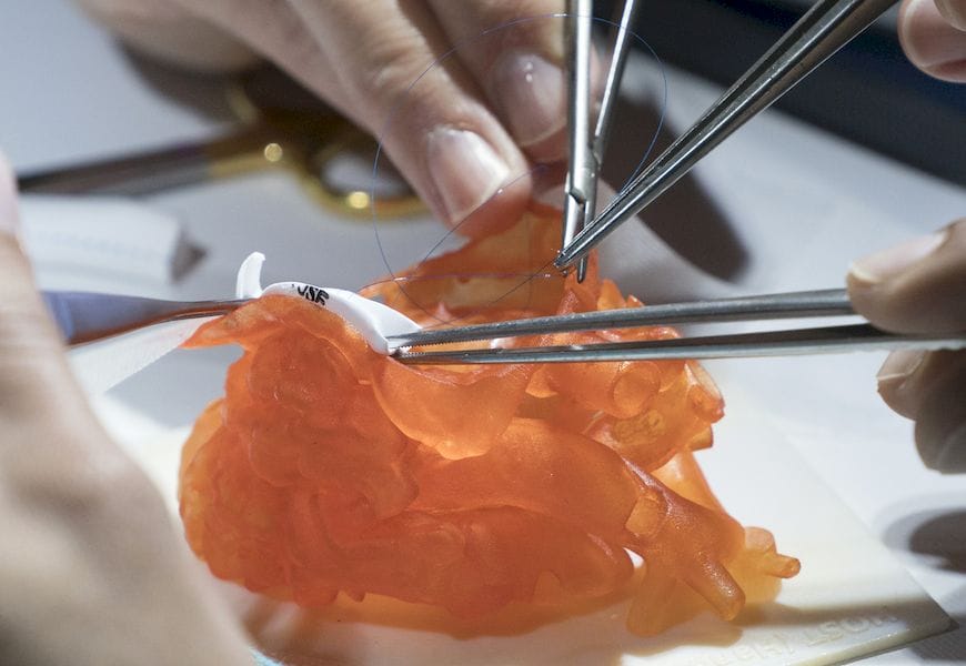  Surgeons practicing on a 3D printed surgical model instae of  