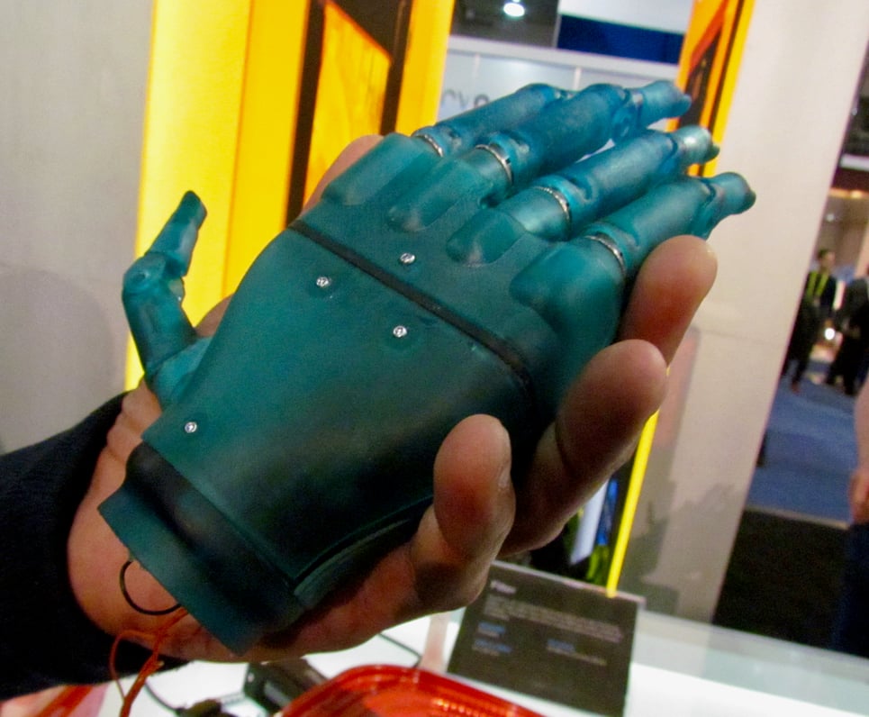  Handsmith's 3D printed prosthetic hand 