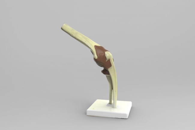  A 3D model of an elbow joint from Threeding.com and Artec 