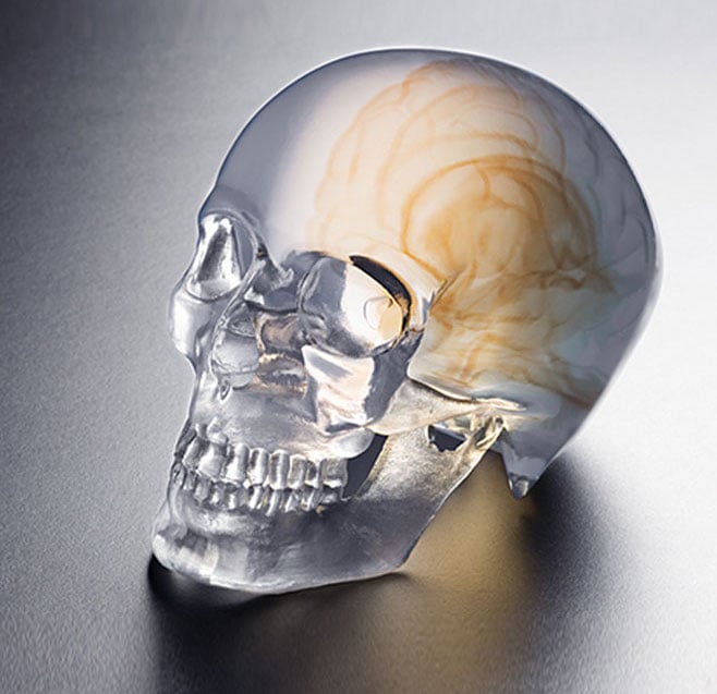 A 3D printed skull made on one of UnionTech's resin-based 3D printers 
