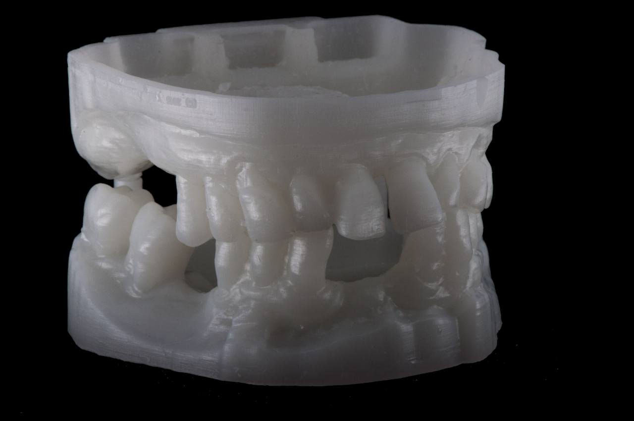  Sample dental print by Arfona's r.Pod desktop 3D printer 