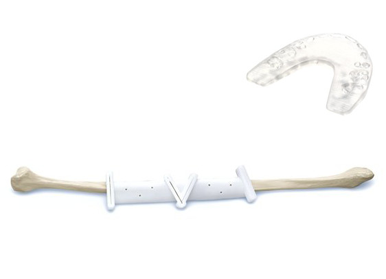  A 3D-printed medical from DePuy Synthes. (Image courtesy of DePuy Synthes.) 