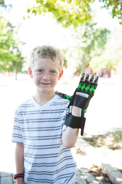  Luke wearing a 3D printed prosthesis 