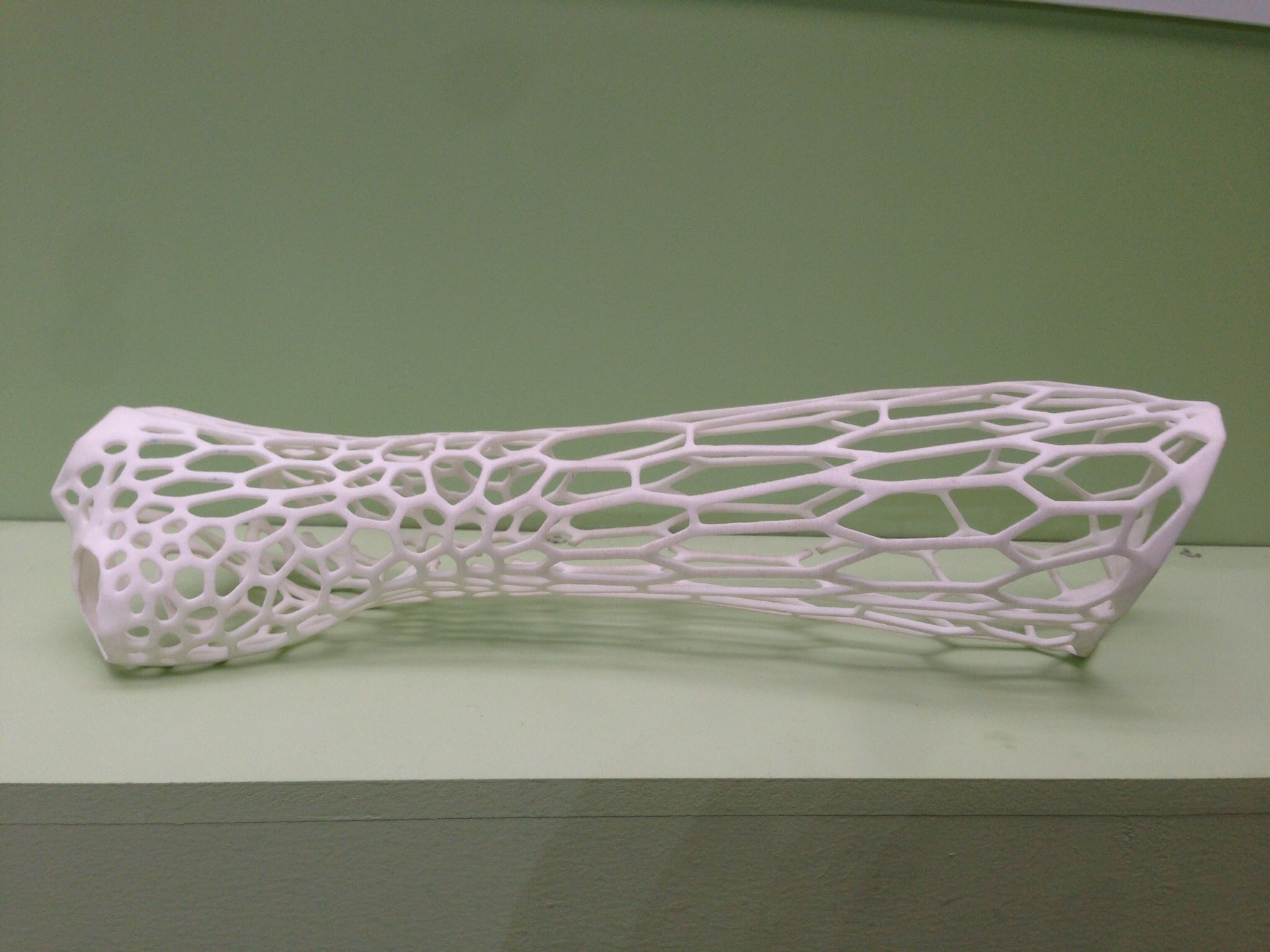  An early attempt at a 3D printed cast, made in 2013 