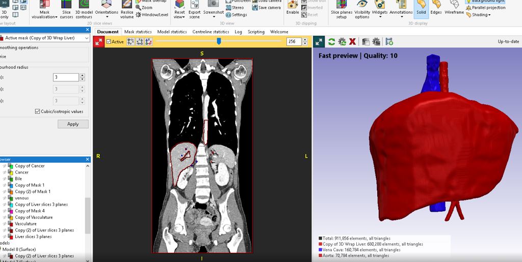 Solving Image-Based Medical 3D Printing Challenges