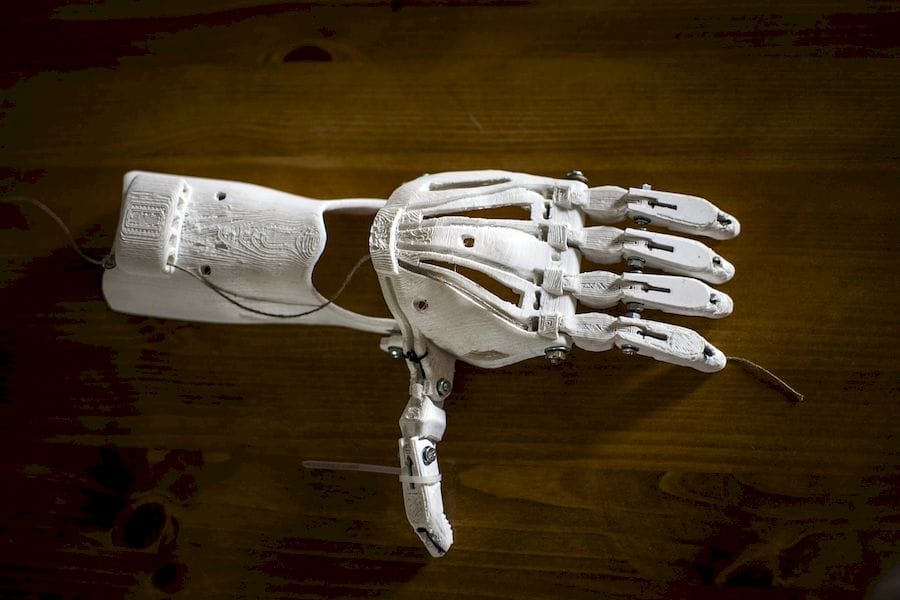  A 3D printed prosthetic 