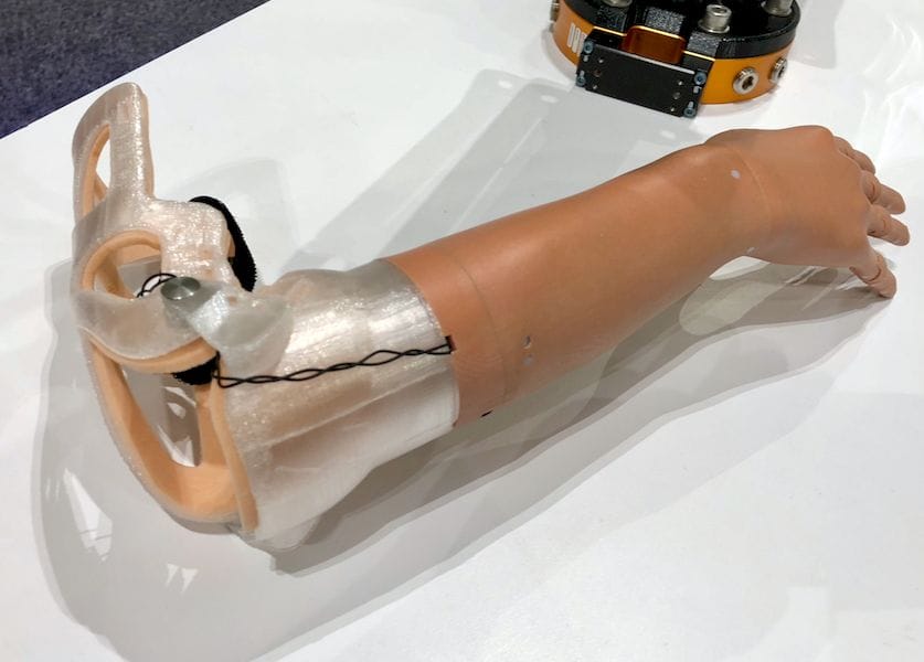  Unlimited Tomorrow's highly sophisticated 3D printed prosthetic arm 
