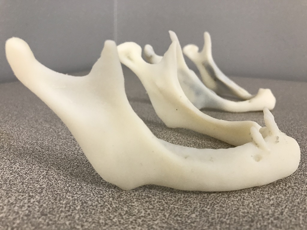  3D printed mandibular model [Image via Stratasys] 