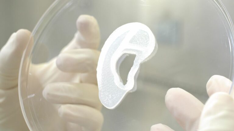 3D Printed Ears First Used in Human Patient