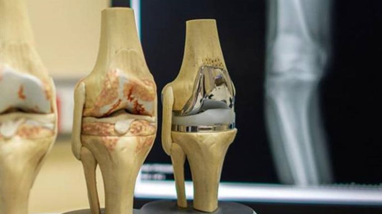 Taking Advantage of 3D Printing for Enhanced Elective Surgeries During the Coronavirus Pandemic