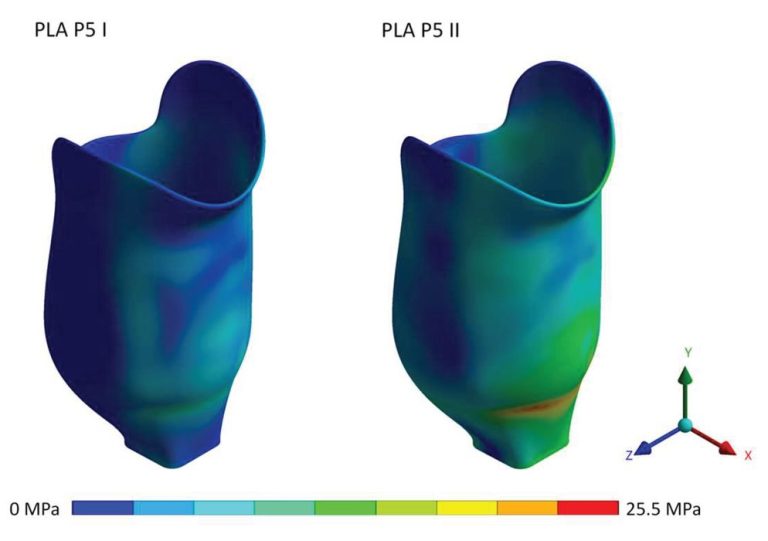 Could PLA be Used to 3D Print Prosthetic Joints?