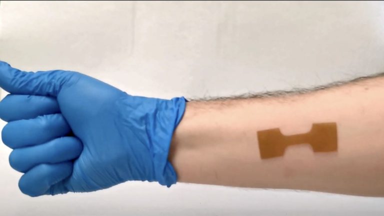 Custom-Fit Healing: Advancements in Wound Dressings through 3D Printing