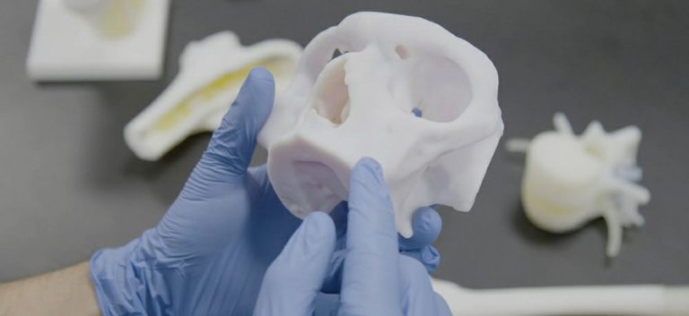 Enhanced Patient Care: The Power of 3D Printed Anatomical Models