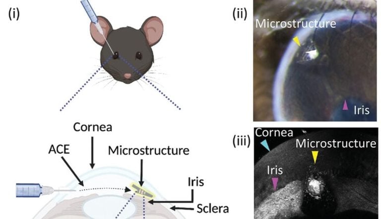 Innovative 3D Printed Bio-Implants: A New Approach Using the Eye