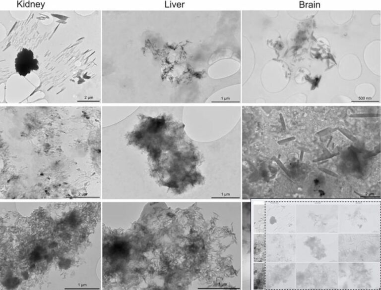 Microplastic Pollution: Study Shows High Concentrations in Human Brain Tissue